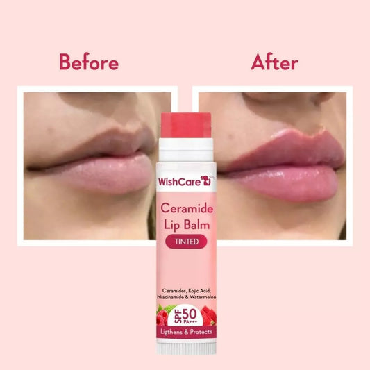 WishCare Tinted Ceramide Lip Balm For Lip Lightening 5gm